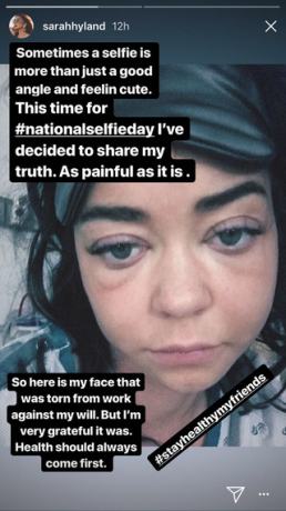 Modern familjs Sarah Hyland har legat in på sjukhus och delar en smärtsam selfie av hennes svullna ansikte